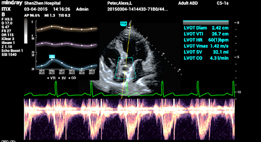 Smart VTI