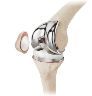 Knee